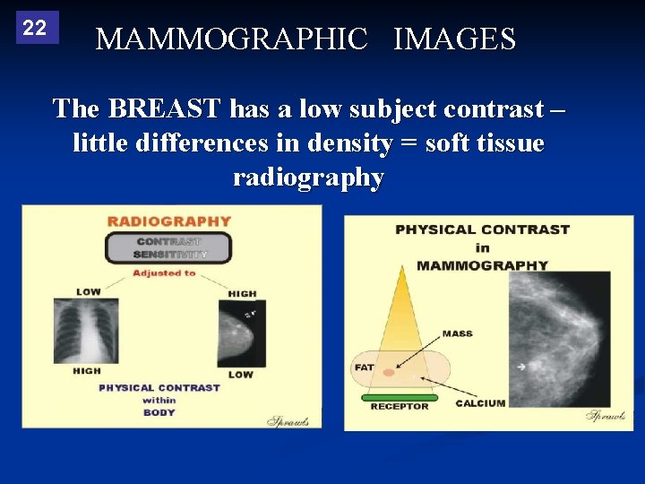 22 MAMMOGRAPHIC IMAGES The BREAST has a low subject contrast – little differences in