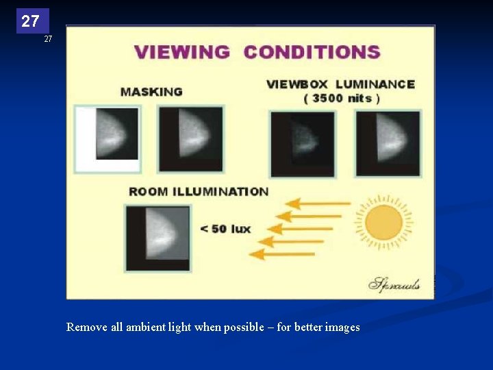 27 27 Remove all ambient light when possible – for better images 