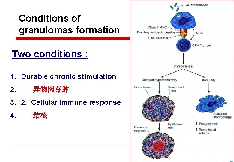 Conditions of granulomas formation Two conditions : 1. Durable chronic stimulation 2. 异物肉芽肿 3.