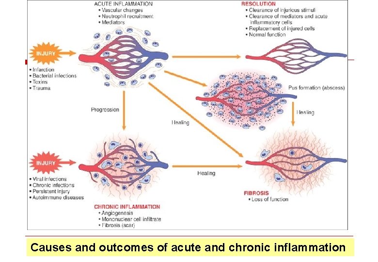 Causes and outcomes of acute and chronic inflammation 