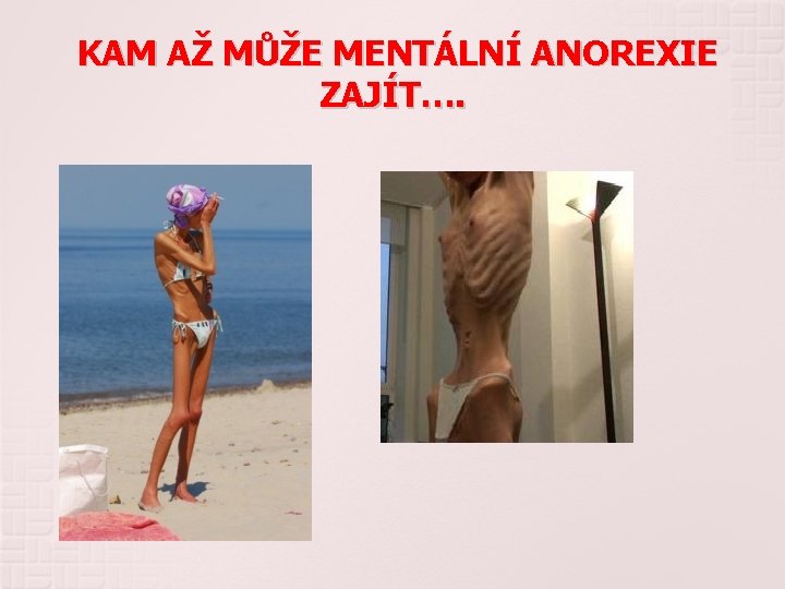 KAM AŽ MŮŽE MENTÁLNÍ ANOREXIE ZAJÍT…. 