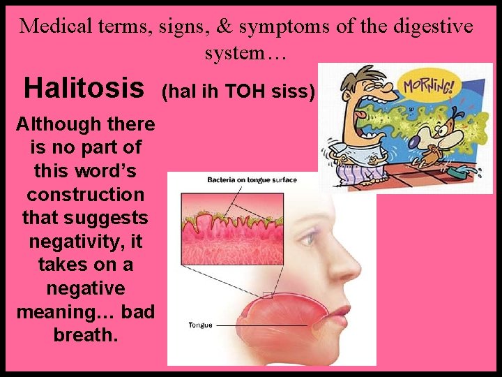 Medical terms, signs, & symptoms of the digestive system… Halitosis Although there is no