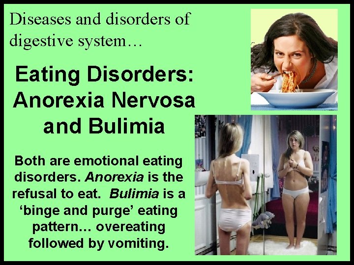 Diseases and disorders of digestive system… Eating Disorders: Anorexia Nervosa and Bulimia Both are