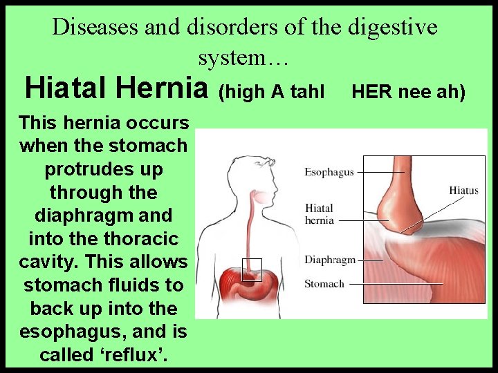 MEDICAL TERMINOLOGY PART 14 THE DIGESTIVE SYSTEM Constructed