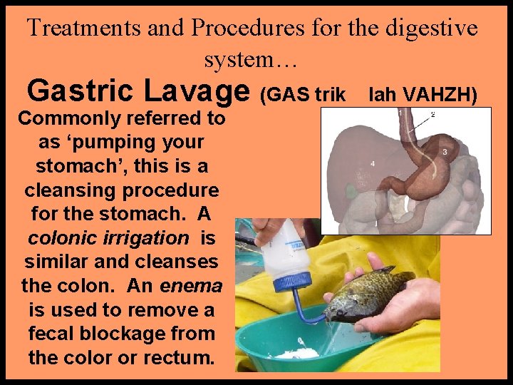 Treatments and Procedures for the digestive system… Gastric Lavage (GAS trik Commonly referred to