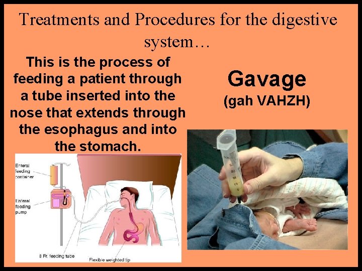 Treatments and Procedures for the digestive system… This is the process of feeding a