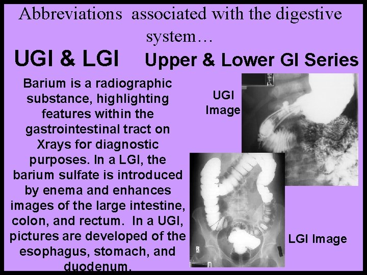 Abbreviations associated with the digestive system… UGI & LGI Upper & Lower GI Series