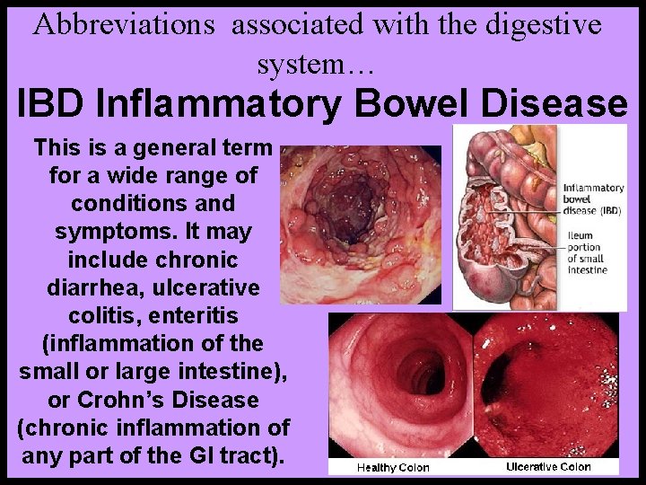 Abbreviations associated with the digestive system… IBD Inflammatory Bowel Disease This is a general