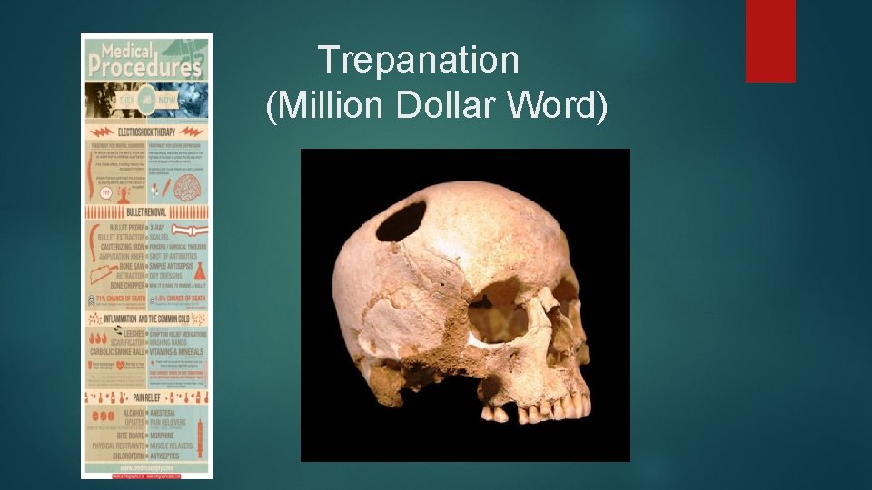 Trepanation (Million Dollar Word) 