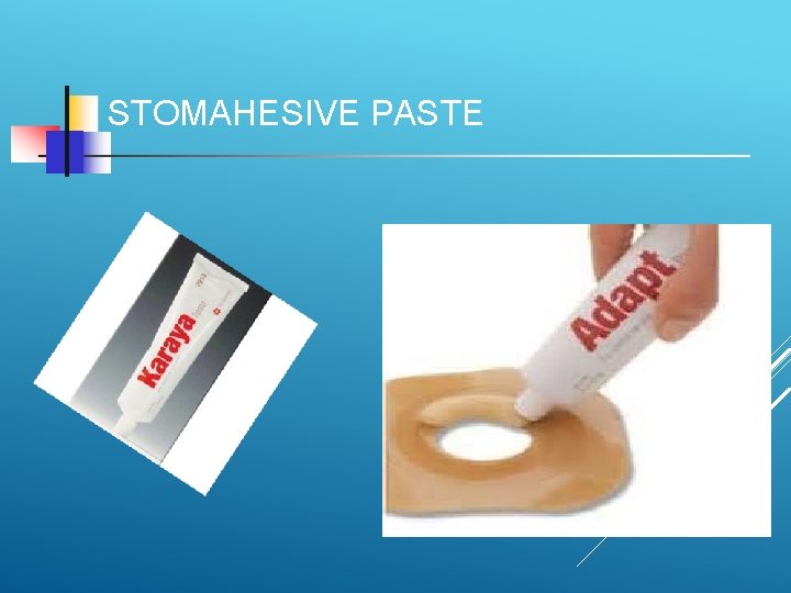 STOMAHESIVE PASTE 