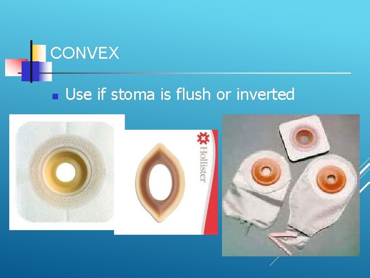 CONVEX Use if stoma is flush or inverted 