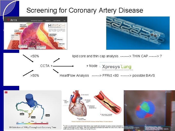 Screening for Coronary Artery Disease <50% lipid core and thin cap analysis ----> THIN