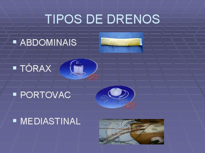 TIPOS DE DRENOS ABDOMINAIS TÓRAX PORTOVAC MEDIASTINAL 