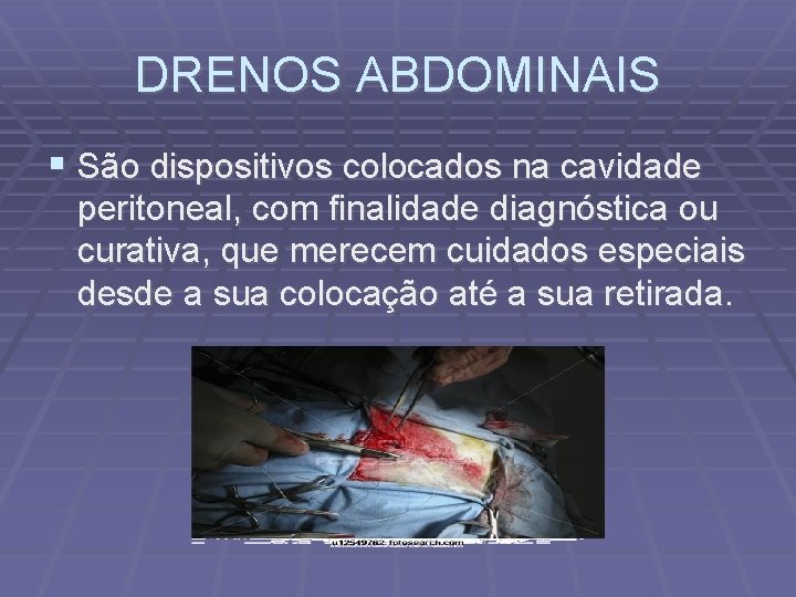 DRENOS ABDOMINAIS São dispositivos colocados na cavidade peritoneal, com finalidade diagnóstica ou curativa, que