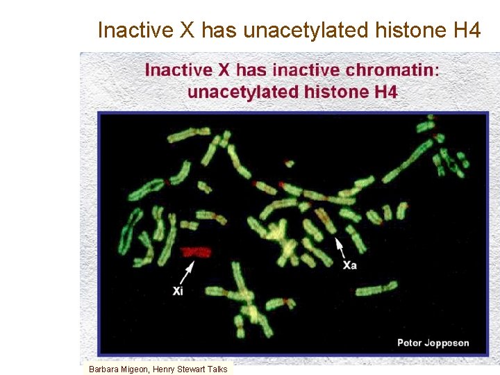 Inactive X has unacetylated histone H 4 Barbara Migeon, Henry Stewart Talks 