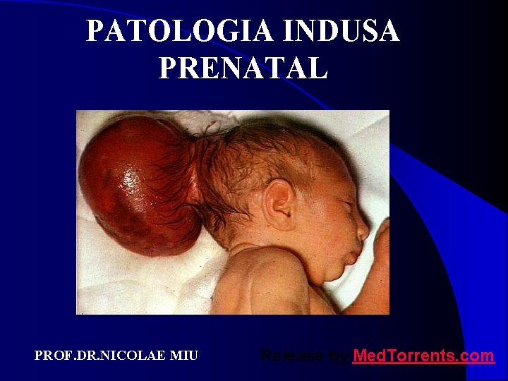 PATOLOGIA INDUSA PRENATAL PROF. DR. NICOLAE MIU Release by Med. Torrents. com 