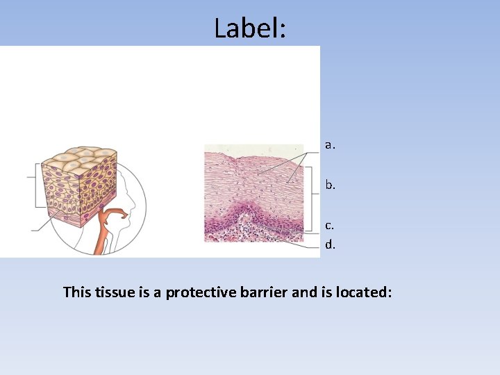 Label: a. b. c. d. This tissue is a protective barrier and is located: