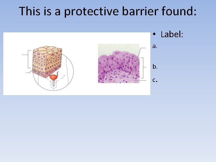 This is a protective barrier found: • Label: a. b. c. 