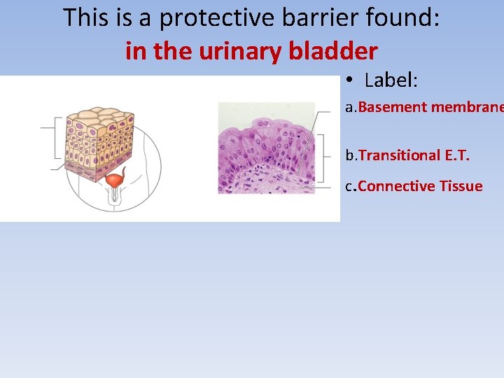 This is a protective barrier found: in the urinary bladder • Label: a. Basement