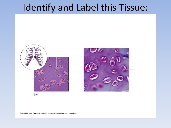 Identify and Label this Tissue: 