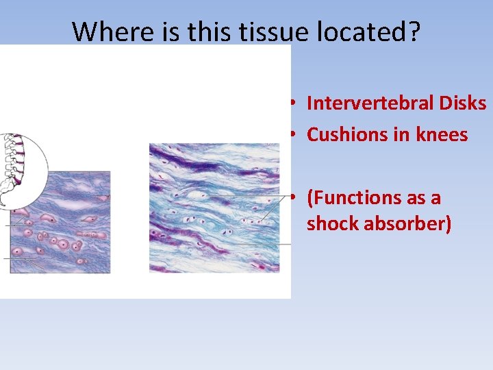 Where is this tissue located? • Intervertebral Disks • Cushions in knees • (Functions