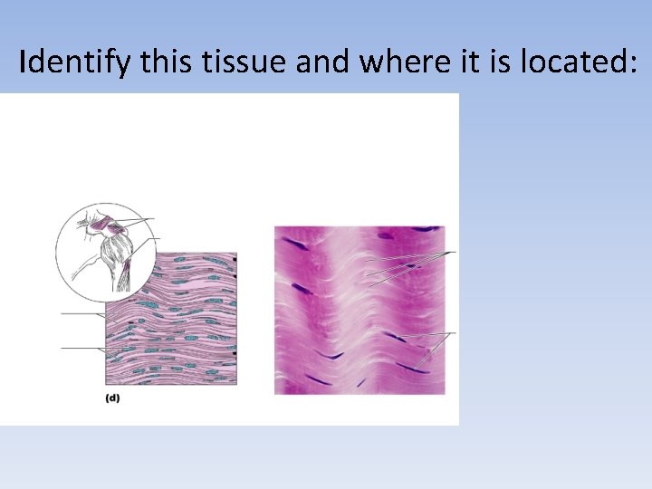 Identify this tissue and where it is located: 
