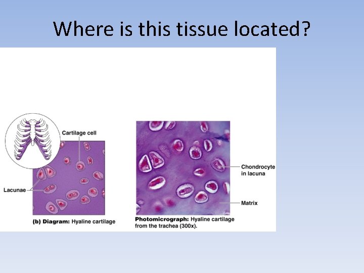 Where is this tissue located? 