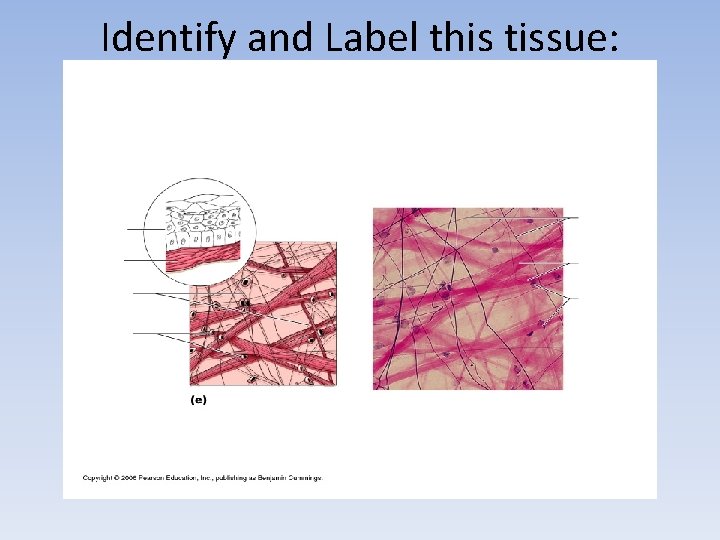 Identify and Label this tissue: 