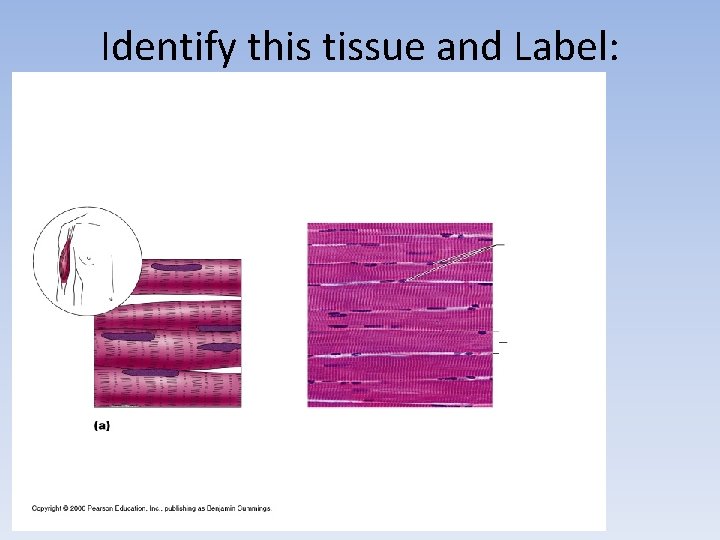 Identify this tissue and Label: 