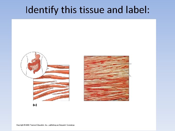 Identify this tissue and label: 
