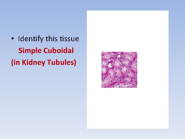  • Identify this tissue Simple Cuboidal (in Kidney Tubules) 