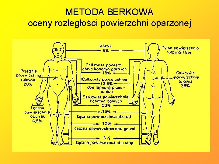 METODA BERKOWA oceny rozległości powierzchni oparzonej 