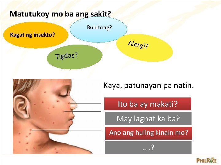 Matutukoy mo ba ang sakit? Bulutong? Kagat ng insekto? Alergi? Tigdas? Kaya, patunayan pa