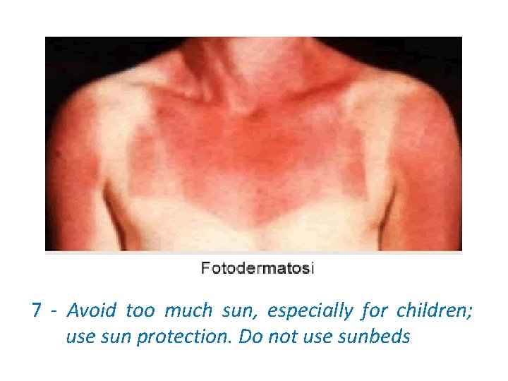 7 - Avoid too much sun, especially for children; use sun protection. Do not