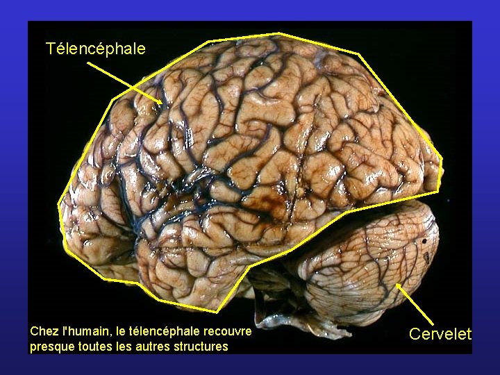 Télencéphale Chez l'humain, le télencéphale recouvre presque toutes les autres structures Cervelet 
