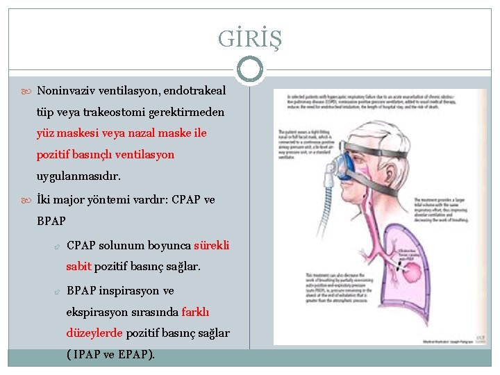 GİRİŞ Noninvaziv ventilasyon, endotrakeal tüp veya trakeostomi gerektirmeden yüz maskesi veya nazal maske ile