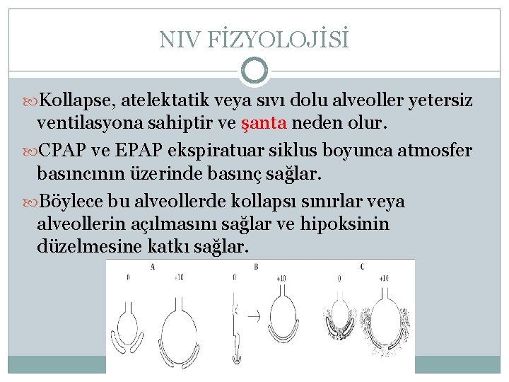 NIV FİZYOLOJİSİ Kollapse, atelektatik veya sıvı dolu alveoller yetersiz ventilasyona sahiptir ve şanta neden