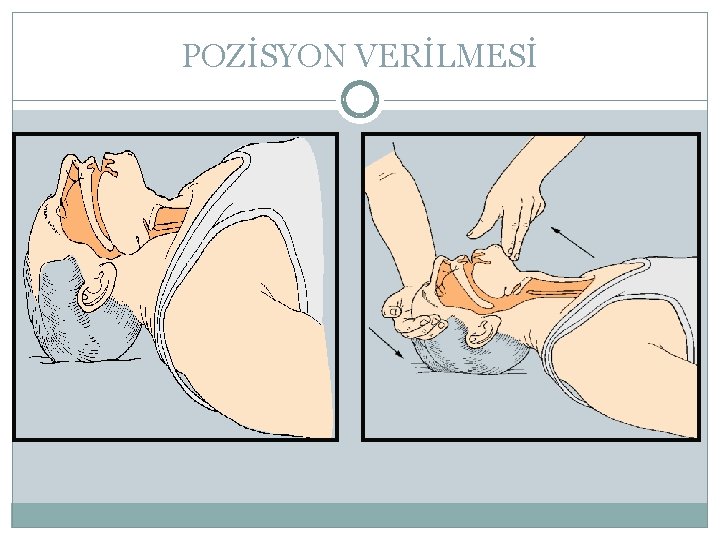 POZİSYON VERİLMESİ 