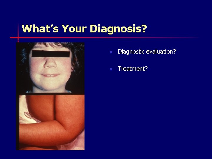 What’s Your Diagnosis? n Diagnostic evaluation? n Treatment? 