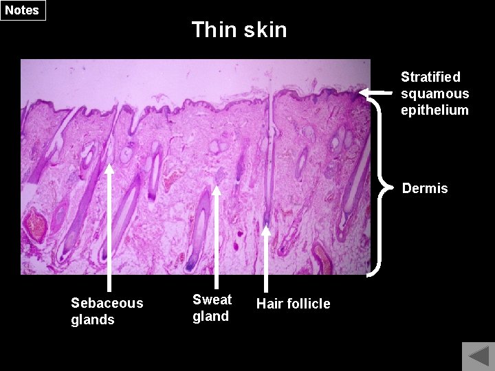 Notes Thin skin Stratified squamous epithelium Dermis Sebaceous glands Sweat gland Hair follicle 