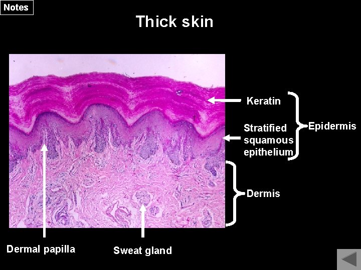 Notes Thick skin Keratin Stratified squamous epithelium Dermis Dermal papilla Sweat gland Epidermis 