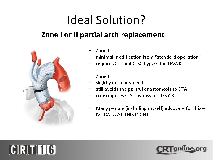 Ideal Solution? Zone I or II partial arch replacement • Zone I - minimal