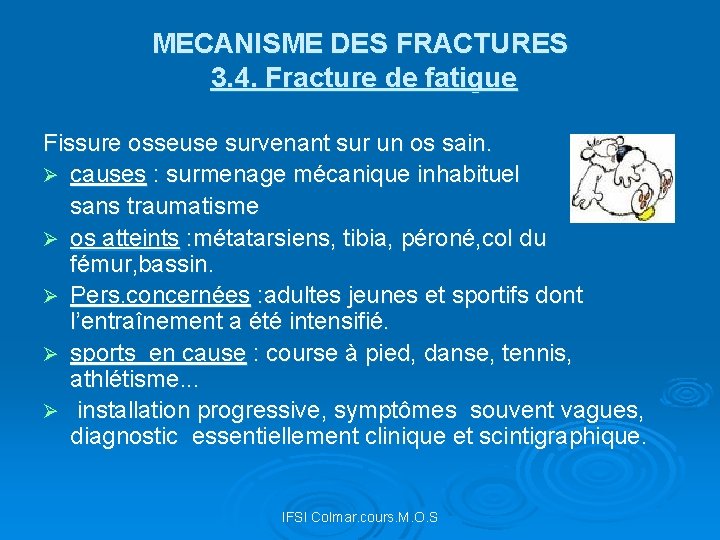 MECANISME DES FRACTURES 3. 4. Fracture de fatigue Fissure osseuse survenant sur un os