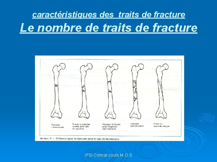 caractéristiques des traits de fracture Le nombre de traits de fracture IFSI Colmar. cours.