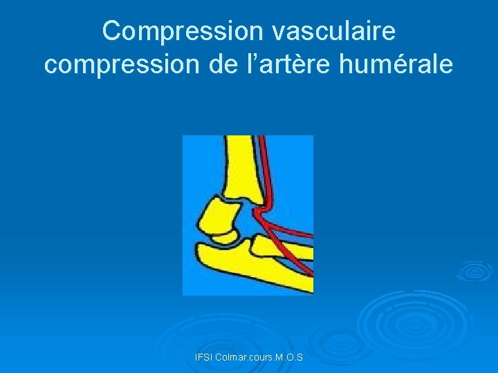 Compression vasculaire compression de l’artère humérale IFSI Colmar. cours. M. O. S 