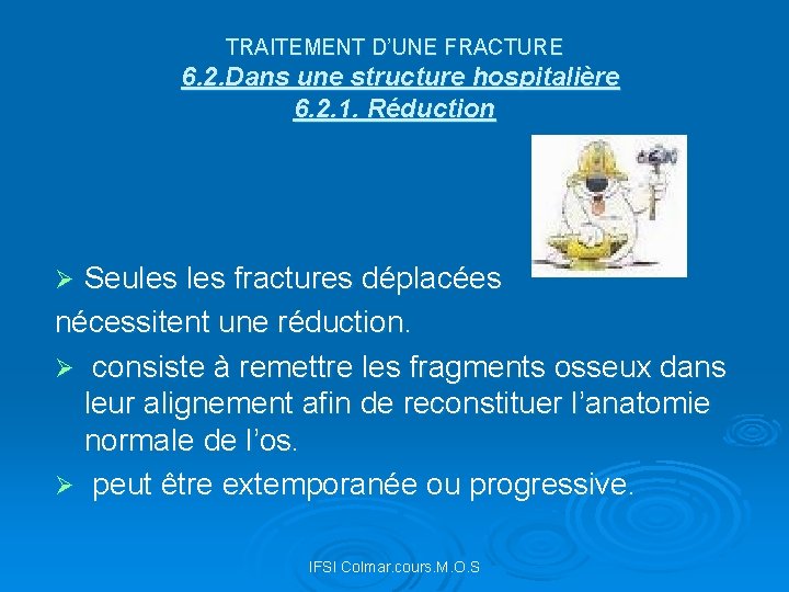 TRAITEMENT D’UNE FRACTURE 6. 2. Dans une structure hospitalière 6. 2. 1. Réduction Seules