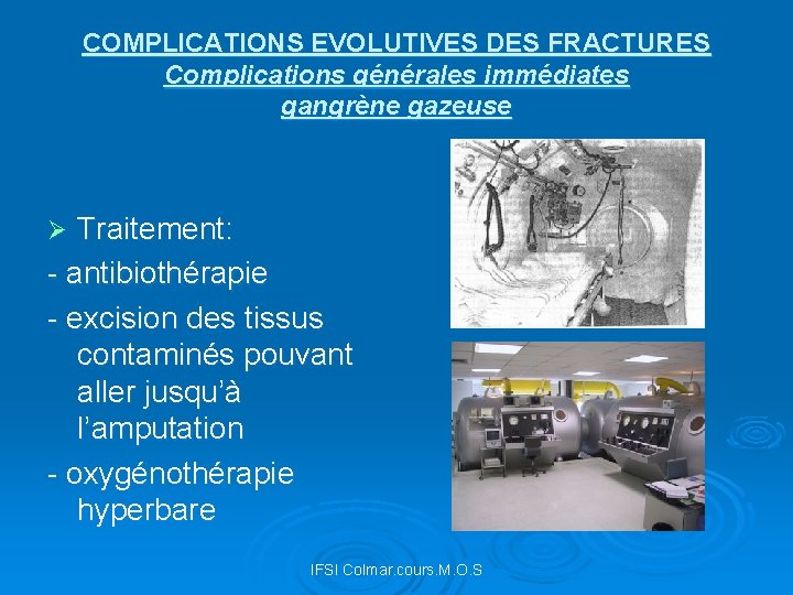 COMPLICATIONS EVOLUTIVES DES FRACTURES Complications générales immédiates gangrène gazeuse Traitement: - antibiothérapie - excision