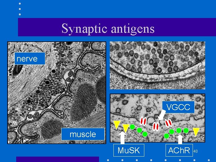 Synaptic antigens nerve VGCC muscle Mu. SK ACh. R 40 