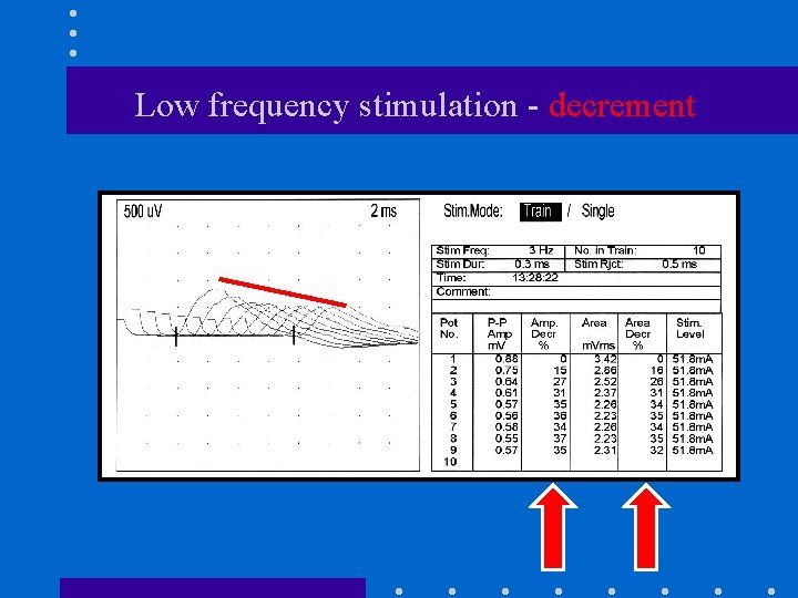 Low frequency stimulation - decrement 