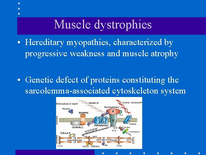 Muscle dystrophies • Hereditary myopathies, characterized by progressive weakness and muscle atrophy • Genetic